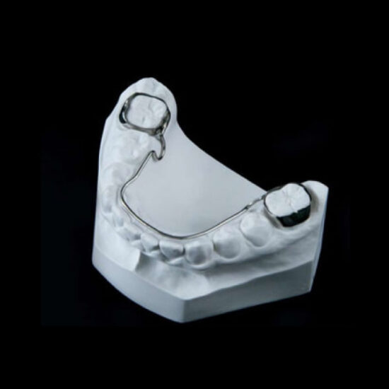 Maxillary Removable Bilateral Space Maintenance (Nance Appliance ...