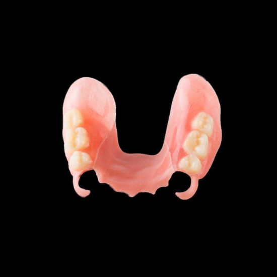 Cr/Co or Titanium Partial Denture – German Zahn Dental Lab