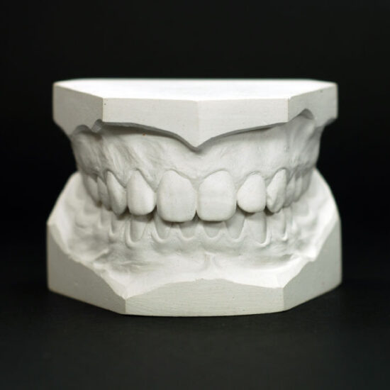 Fixed Bilateral Space Maintainer German Zahn Dental Lab