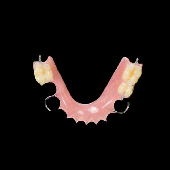 Duracetal® Clasp – German Zahn Dental Lab